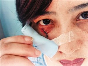 手机看新闻伤脸吗手机看新闻哪个app好-第1张图片-太平洋在线下载